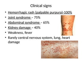 Cardiovascular Rash Systemic Vasculitis IgA vasculitis .pptx