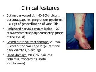 Pyoderma Eyelid Systemic Vasculitis IgA vasculitis .pptx