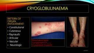 Systemic vasculitis 2016 shj | PPTX