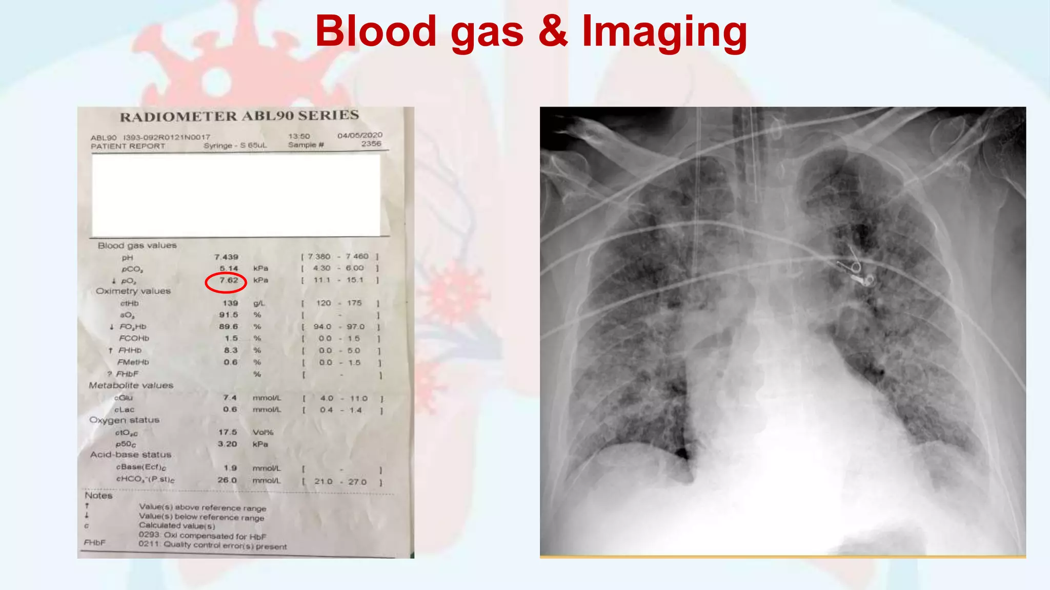 Blood gas & Imaging
 