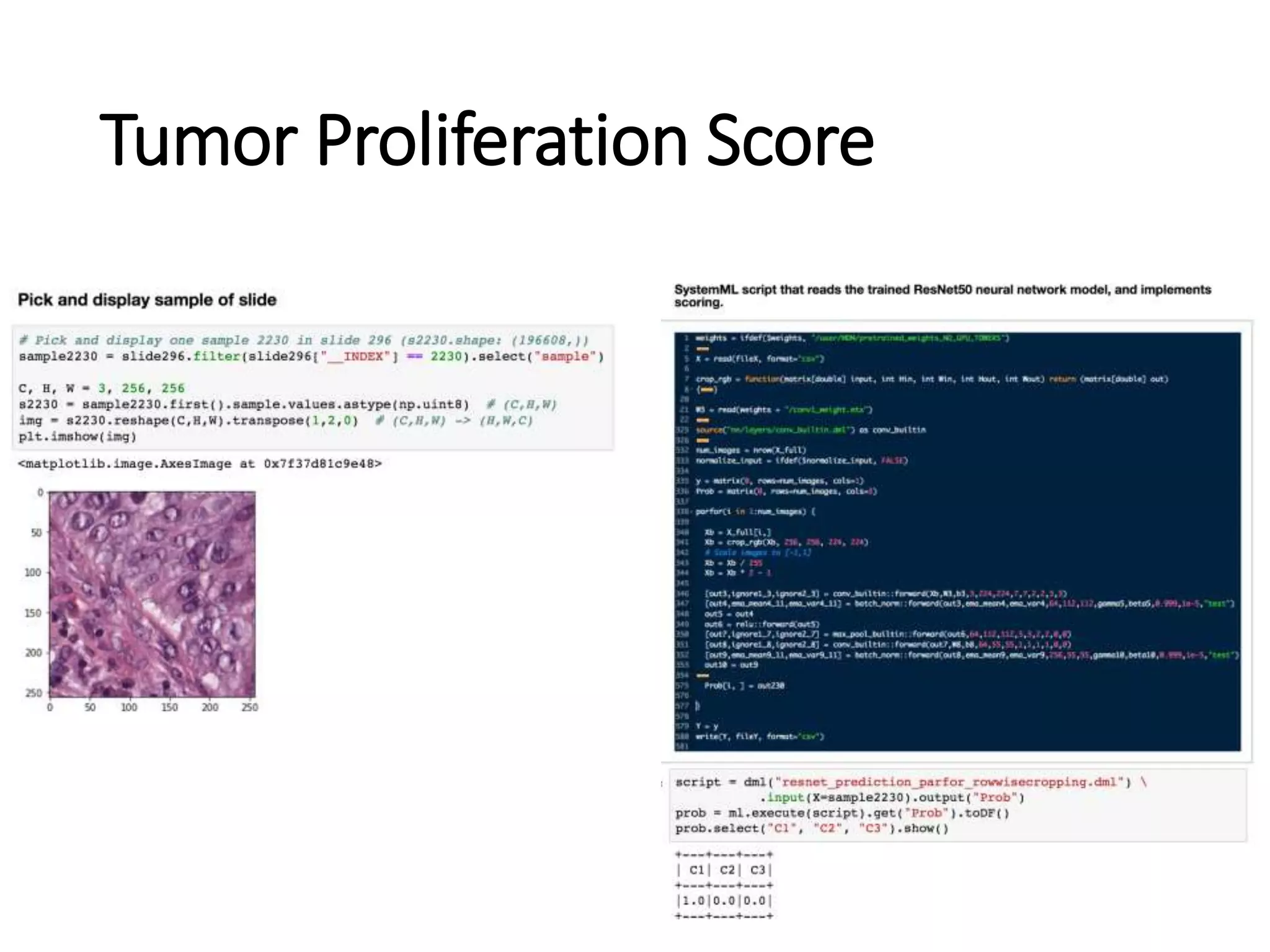 Tumor Proliferation Score
 