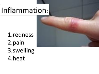 Inflammation:Inflammation:
1.redness
2.pain
3.swelling
4.heat
 