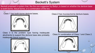 Comprehensive Overview of Partially Dentulous Arch Classification ...
