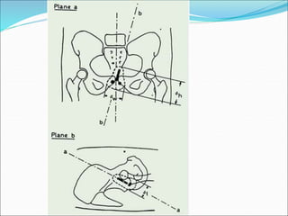 Systems of Brachy.ppt