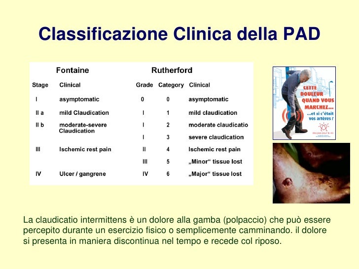 Nuovo significa per trattamento di un fungo su unghie di gambe