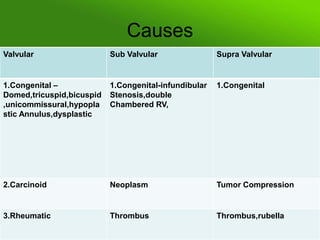 Causes
Valvular

Sub Valvular

Supra Valvular

1.Congenital –
Domed,tricuspid,bicuspid
,unicommissural,hypopla
stic Annulus,dysplastic

1.Congenital-infundibular
Stenosis,double
Chambered RV,

1.Congenital

2.Carcinoid

Neoplasm

Tumor Compression

3.Rheumatic

Thrombus

Thrombus,rubella

 