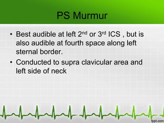 PS Murmur
• Best audible at left 2nd or 3rd ICS , but is
also audible at fourth space along left
sternal border.
• Conducted to supra clavicular area and
left side of neck

 