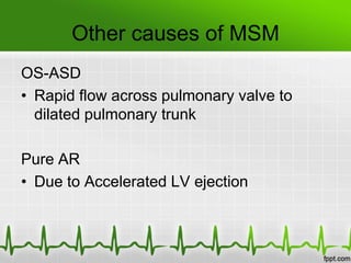 Other causes of MSM
OS-ASD
• Rapid flow across pulmonary valve to
dilated pulmonary trunk

Pure AR
• Due to Accelerated LV ejection

 