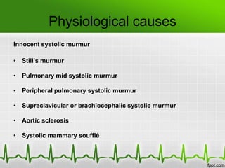 Physiological causes
Innocent systolic murmur
• Still’s murmur
• Pulmonary mid systolic murmur
• Peripheral pulmonary systolic murmur
• Supraclavicular or brachiocephalic systolic murmur
• Aortic sclerosis

• Systolic mammary soufflé

 