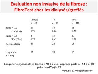 Dialyse
n = 50
Tx
n = 60
Total
n = 110
Score < 0.2
NPV (F≤1)
21
0.71
14
0.86
35
0.77
Score > 0.6
PPV (F2-4)
4
0.75
13
0.69
17
0.71
% discordance 28 22 25
Diagnostic
accuracy
72 78 75
Longueur moyenne de la biopsie : 19 ± 7 mm; espaces porte n : 14 ± 7; 50
patients (45%) ≥ F2
Evaluation non invasive de la fibrose :
FibroTest chez les dialysés/greffés
Varaut et al. Transplantation 05
 