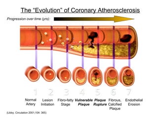 The “Evolution” of Coronary Atherosclerosis
(Libby. Circulation 2001;104: 365)
Normal
Artery
Lesion
Initiation
Fibro-fatty
Stage
Vulnerable
Plaque
Plaque
Rupture
Fibrous,
Calcified
Plaque
Endothelial
Erosion
Progression over time (yrs):
 