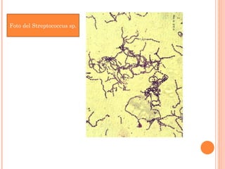 Foto del Streptococcus sp.
 