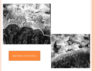 MUCOSA COLÓNICA
 