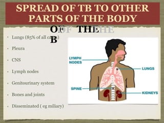 SPREA
PAR
D OF
OF
TB
TB T
TO
OO TS
S
OF
OF THE
THE
B
TH
HER
E
R ODY
Y
SPREAD OF TB TO OTHER
PARTS OF THE BODY
Lungs (85% of all cases)
Pleura
CNS
Lymph nodes
Genitourinary system
Bones and joints
Disseminated ( eg miliary)
 