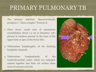 PRIMARY PULMONARY TB
The primary infection characteristically
produces a " Ghon complex" formed of:
1. Ghon focus: small area of pneumonic
consolidation about 1-3 cm in diameter, sub-
pleural in location present in the base of the
upper lobe or apex of the lower lobe
2. Tuberculous lymphangitis: of the draining
lymphatic channels
3. Tuberculous lymphadenitis: of the
tracheobronchial nodes which are enlarged,
matted together and their cut surface show
areas of caseous necrosis
 
