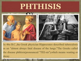 PHTHI
HI
SI
SI
S
S
PHTHISIS
e
e
k
kpphhyssiicciiaannHHiippppoocrcraatteess
d
d
e
e
s
s f
fa
at
ta
al
l d
dis
isea
as
se o
of
f t
th
he
lu
lun
ng
gs
s p
pro
on
no
ou
un
nced
d
"TE"TEEE-sis"")),wh,whii
s
sc
cr
ri
ib
be
ed
d t
tu
ub
be
er
rc
cu
ul
lo
os
si
is
s
."
."T
Th
he G
Gree
eek
ks
ca
call
lled
d ch
h m
mea
an
ns
s
w
wa
as
sti
tin
ng
g o
or
In
In 46o
46o B
B..C
C.,th
.,the
e
G
G
r
r
e
e
aas a
a
n
n""aalmlmoostta
a
l
l
w
w
a
a
y
y
ththe ddisiseaassepphhtthhiisis((
ddeecaayy..
In 46o B.C.,the Greek physician Hippocrates described tuberculosis
as an "almost always fatal disease of the lungs."The Greeks called
the disease phthisis(pronounced "TEE-sis"),which means wasting or
decay.
Hamdi Turkey
 
