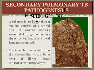 A tubercle is no larger than 3
cm and consists of a central
area of caseous necrosis
surrounded by granulomatous
tissue containing the typical
Langhans giant cells
The tubercle is separated from
the surrounding tissue by a
layer of fibrous tissue
infiltrated with lymphocytes
SE
SEC
CO
ON
D
P
P
A
ARY
Y P
P
U
L
M
O
U
L
M
O
N
THO
OGE
GENE
N
ES
NARYARY
T
B
T
B
S
SECONDARY PULMONARY TB
PATHOGENESIIS
 