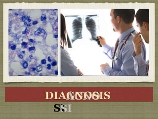 DIAG
AGNO
SI
SI
S
DIAGNOSIS
 