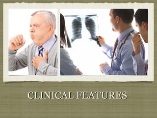 CLINICAL FEATURESCLINICAL FEATURES
 