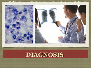DIAGNOSISDIAGNOSISDIAGNOSISDIAGNOSIS
 
