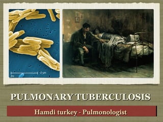 PULMONARY TUBERCULOSISPULMONARY TUBERCULOSIS
Hamdi turkey - PulmonologistHamdi turkey - PulmonologistHamdi turkey - PulmonologistHamdi turkey - Pulmonologist
 
