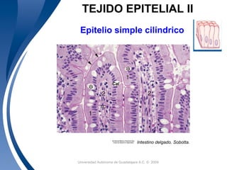 Universidad Autónoma de Guadalajara A.C. © 20099
TEJIDO EPITELIAL II
Epitelio simple cilíndrico
Intestino delgado. Sobotta.
Cal
TC
 