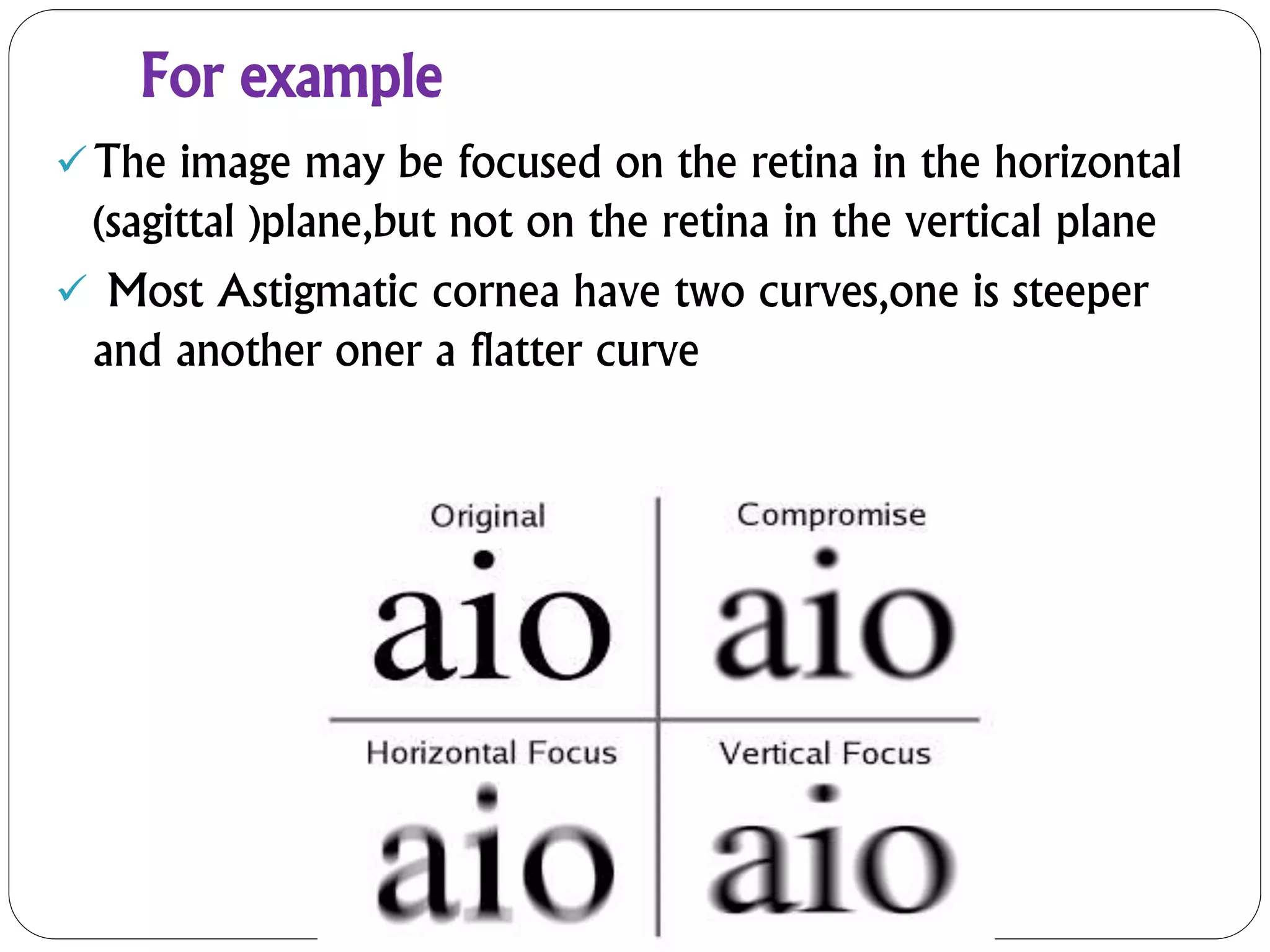 For example
The image may be focused on the retina in the horizontal
(sagittal )plane,but not on the retina in the vertical plane
 Most Astigmatic cornea have two curves,one is steeper
and another oner a flatter curve
 