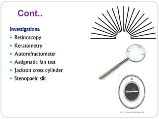 Cont..
Investigations:
 Retinoscopy
 Keratometry
 Autorefractometer
 Astigmatic fan test
 Jackson cross cylinder
 Stenopaeic slit
 