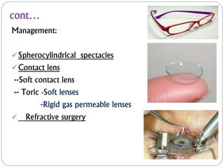 cont…
Management:
Spherocylindrical spectacles
Contact lens
--Soft contact lens
-- Toric -Soft lenses
-Rigid gas permeable lenses
 Refractive surgery
 