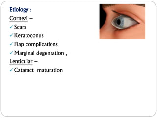 Etiology :
Corneal –
Scars
Keratoconus
Flap complications
Marginal degenration ,
Lenticular –
Cataract maturation
 