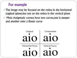 For example
The image may be focused on the retina in the horizontal
(sagittal )plane,but not on the retina in the vertical plane
 Most Astigmatic cornea have two curves,one is steeper
and another oner a flatter curve
 