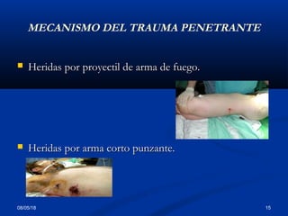 08/05/18 15
MECANISMO DEL TRAUMA PENETRANTE
 Heridas por proyectil de arma de fuego.Heridas por proyectil de arma de fuego.
 Heridas por arma corto punzante.Heridas por arma corto punzante.
 