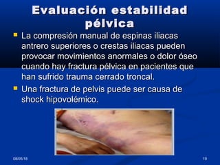 Evaluación estabilidadEvaluación estabilidad
pélvicapélvica
 La compresión manual de espinas iliacasLa compresión manual de espinas iliacas
antrero superiores o crestas iliacas puedenantrero superiores o crestas iliacas pueden
provocar movimientos anormales o dolor óseoprovocar movimientos anormales o dolor óseo
cuando hay fractura pélvica en pacientes quecuando hay fractura pélvica en pacientes que
han sufrido trauma cerrado troncal.han sufrido trauma cerrado troncal.
 Una fractura de pelvis puede ser causa deUna fractura de pelvis puede ser causa de
shock hipovolémico.shock hipovolémico.
08/05/18 19
 