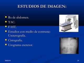 08/05/18 24
ESTUDIOS DE IMAGEN:ESTUDIOS DE IMAGEN:
 Rx de abdomen.Rx de abdomen.
 TAC.TAC.
 FAST.FAST.
 Estudios con medio de contraste:Estudios con medio de contraste:
Ureterografía.Ureterografía.
 Cistografía.Cistografía.
 Urograma excretor.Urograma excretor.
 