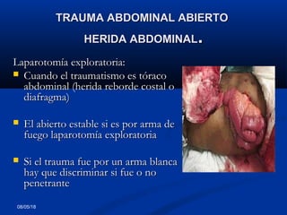 08/05/18
TRAUMA ABDOMINAL ABIERTOTRAUMA ABDOMINAL ABIERTO
HERIDA ABDOMINALHERIDA ABDOMINAL..
Laparotomía exploratoria:Laparotomía exploratoria:
 Cuando el traumatismo es tóracoCuando el traumatismo es tóraco
abdominal (herida reborde costal oabdominal (herida reborde costal o
diafragma)diafragma)
 El abierto estable si es por arma deEl abierto estable si es por arma de
fuego laparotomía exploratoriafuego laparotomía exploratoria
 Si el trauma fue por un arma blancaSi el trauma fue por un arma blanca
hay que discriminar si fue o nohay que discriminar si fue o no
penetrantepenetrante
  
 