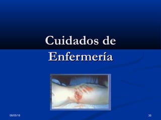 08/05/18 35
Cuidados deCuidados de
EnfermeríaEnfermería
 