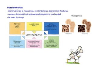 OSTEOPOROSIS:
- disminución de la masa ósea, con tendencia a aparición de fracturas.
- causas: disminución de estrógenos/testosterona con la edad.
- factores de riesgo:
 