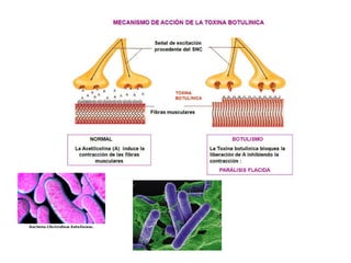 T 2-aparato locomotor
