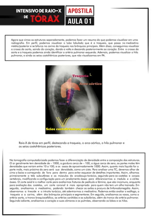 Agora que vimos as estruturas separadamente, podemos fazer um resumo do que podemos visualizar em uma
radiografia. Em perfil, podemos visualizar o tubo lobulado que é a traqueia, que passa no mediastino
médio/posterior e se bifurca na carina da traqueia nos brônquios principais. Além disso, conseguimos visualizar
a crossa da aorta, saindo do coração, dando a volta e descendo posteriormente ao coração. Entre a crossa da
aorta e a traqueia podemos ainda identificar a artéria pulmonar esquerda. Ademais, podemos visualizar o hilo
pulmonar, e ainda os seios costofrênicos posteriores, que não visualizamos em PA.
Na tomografia computadorizada podemos fazer a diferenciação de densidade entre a composição das estruturas.
O ar geralmente tem densidade de – 1000, a gordura cerca de – 100, a água cerca de zero, as partes moles têm
densidades que variam entre 10 a 100, e os ossos de aproximadamente 1000. Assim, quanto mais liquida for a
parte mole, mais próxima do zero será sua densidade, como um cisto. Para analisar uma TC, devemos olhar de
cima a baixo e começando de fora para dentro para evitar esquecer de detalhes importantes. Assim, olhamos
primeiramente a tela subcutânea e os músculos do arcabouço torácico, seguindo para as costelas e corpos
vertebrais, modificando a configuração para um janelamento ósseo para diferenciarmos a medula e o córtex
ósseo. O corte axial é o melhor corte para avaliarmos fraturas de pedículo e lâmina, que são incomuns, enquanto
para avaliação das costelas, um corte coronal é mais apropriado para quem não tem um olho treinado. Em
seguida, analisamos o mediastino, podendo também checar as axilas a procura de linfonodomegalia. Assim,
observamos a tireoide e o introito torácico, até adentrarmos o mediastino. Podemos então avaliar o esôfago, a
traqueia e a carina, além dos brônquios principais e segmentares. Em seguida, analisamos os vasos, como a
artéria aorta, o tronco braquiocefálico, as artérias carótidas e as subclávias, além do tronco da artéria pulmonar.
Seguindo adiante, analisamos o coração e suas câmaras e os pulmões, observando os lobos e os hilos.
Raio-X de tórax em perfil, destacando a traqueia, o arco aórtico, o hilo pulmonar e
os seios costofrênicos posteriores.
INTENSIVO DE RAIO-X
DE
aula 01
 