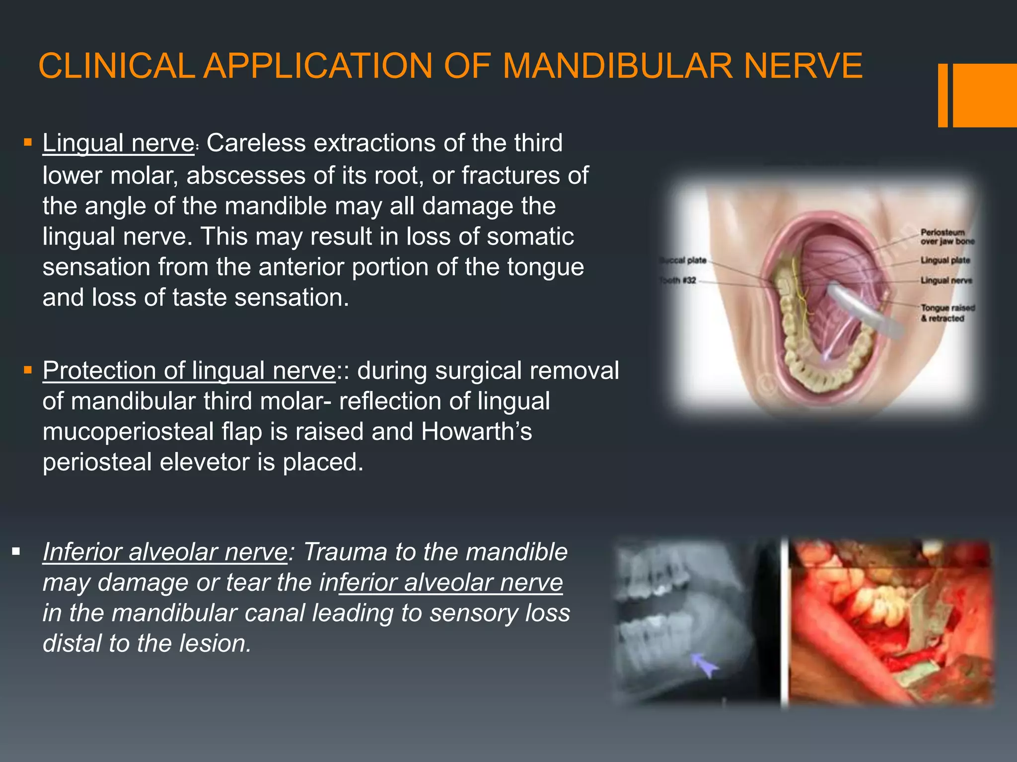 CLINICAL APPLICATION OF MANDIBULAR NERVE
 Lingual nerve: Careless extractions of the third
lower molar, abscesses of its root, or fractures of
the angle of the mandible may all damage the
lingual nerve. This may result in loss of somatic
sensation from the anterior portion of the tongue
and loss of taste sensation.
 Protection of lingual nerve:: during surgical removal
of mandibular third molar- reflection of lingual
mucoperiosteal flap is raised and Howarth’s
periosteal elevetor is placed.
 Inferior alveolar nerve: Trauma to the mandible
may damage or tear the inferior alveolar nerve
in the mandibular canal leading to sensory loss
distal to the lesion.
 