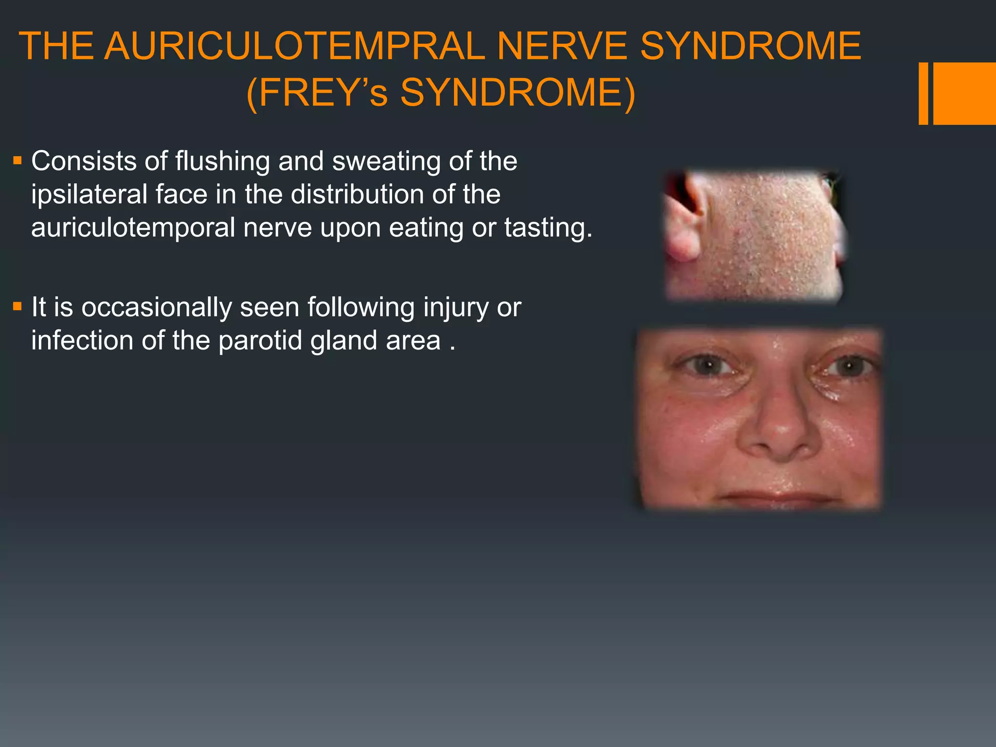 THE AURICULOTEMPRAL NERVE SYNDROME
(FREY’s SYNDROME)
 Consists of flushing and sweating of the
ipsilateral face in the distribution of the
auriculotemporal nerve upon eating or tasting.
 It is occasionally seen following injury or
infection of the parotid gland area .
 