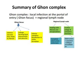 Summary of Ghon complex
 