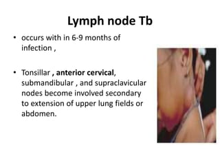 Lymph node Tb
• occurs with in 6-9 months of
infection ,
• Tonsillar , anterior cervical,
submandibular , and supraclavicular
nodes become involved secondary
to extension of upper lung fields or
abdomen.
 