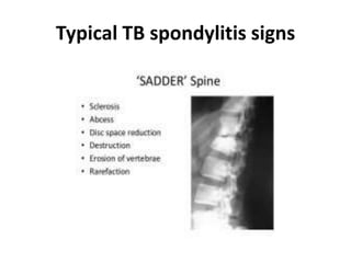 Typical TB spondylitis signs
 