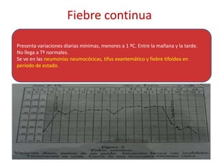 Fiebre continua
124
Presenta variaciones diarias mínimas, menores a 1 ºC. Entre la mañana y la tarde.
No llega a Tº normales.
Se ve en las neumonías neumocócicas, tifus exantemático y fiebre tifoidea en
período de estado.
 