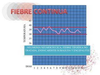 1 2 3 4 5 6 7 8 9 10 11 12 13 14 15 16 17
DIAS
TEMPERATURA
41
40
39
38
37
36
NEUMONIA NEUMOCÓCCICA, FIEBRE TIFOIDEA NO
TRATADA, ENDOCARDITIS SUBAGUDA Y ENCEFALITIS
 
