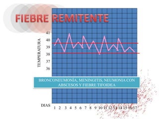 1 2 3 4 5 6 7 8 9 10 11 12 13 14 15 16 17
DIAS
TEMPERATURA
41
40
39
38
37
36
BRONCONEUMONÍA, MENINGITIS, NEUMONIA CON
ABSCESOS Y FIEBRE TIFOIDEA
 