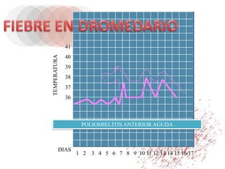 1 2 3 4 5 6 7 8 9 10 11 12 13 14 15 16 17
DIAS
TEMPERATURA
41
40
39
38
37
36
POLIOMIELITIS ANTERIOR AGUDA
 