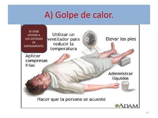 A) Golpe de calor.
56
SE DEBE
APOYAR A
LOS SISTEMAS
DE
ENFRIAMIENTO.
 