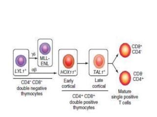 T cell and NK-cell neoplasms | PPTX